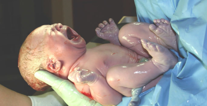Barn som föds med kejsarsnitt har lättare för att bli allergiska i framtiden.